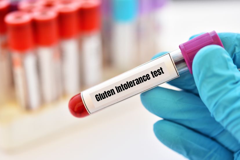 gluten intolerance test