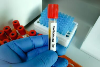 food intolerance blood test